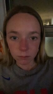 The founder's "Rudolph" nose in early 2024. This is the start of the heart behind FoodFriend.
